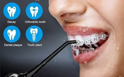 Electric Tooth Punch Dental Cleaner Review: A Game Changer?